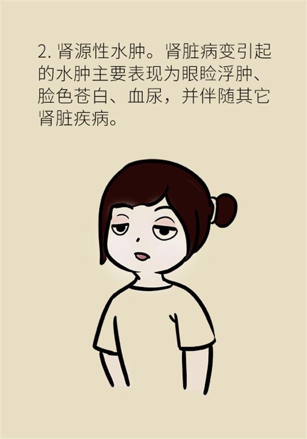 身体出现水肿需要做哪些检查,身体出现水肿吃什么药好