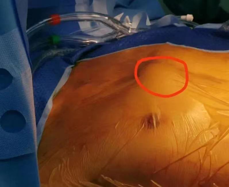 鍋ヨ韩灏忎紮蹇冭剰琛扮,鍋ヨ韩灏忎紮蹇冩