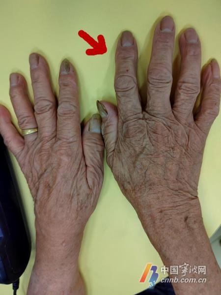 手臂皮肤突然发黑,手臂和小腿发黑怎么回事