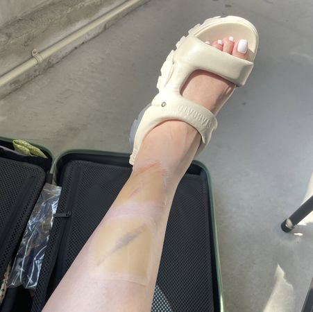 女演员意外出血痛苦,女歌手意外受伤身亡