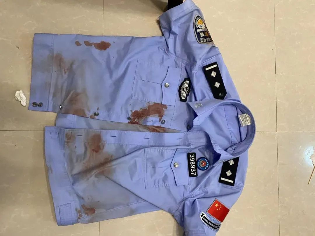 心疼！他从身上，清理出35条蚂蝗……