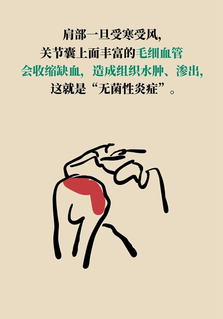 肩膀突然抻着了很疼怎么办,肩膀疼痛感觉筋抻了一样疼