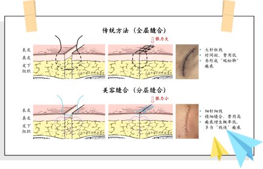 夏天怎么不让伤口留疤,冬天伤口留疤怎么去除