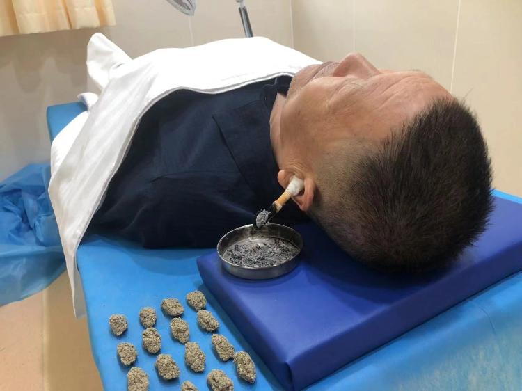 滨州中医医院针灸多少钱,滨州中医院针灸科专家